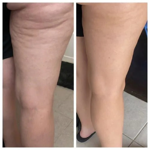 Customer before and after photo