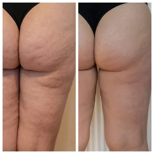 Customer before and after photo