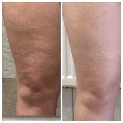 Customer before and after photo