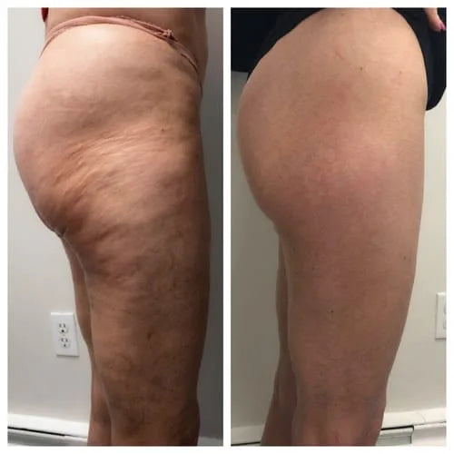 Customer before and after photo